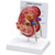 Double-sided Kidney Model showing a normal and diseased kidney