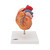 Heart Model with Left Ventricular Hypertrophy G04 3B Scientific