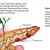 Pancreatitis details of Alcohol & the Body Poster