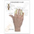Osteoarthritis (OA) Hand Model