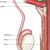 Detail of the Prostate Anatomy Poster