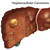 Liver Damage Stages Chart Detail