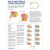 Male and Female Catheterisation Poster