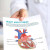 Heart Arrhythmias Patient Education Handout (Printable PDF)