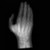 Dorsal X-ray of the Hand Phantom Model