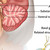 Brain Anatomy Illustration in The Anatomy of Parkinson's Disease Chart / Poster - Laminated