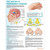 The Anatomy of Parkinson's Disease Chart / Poster - Laminated