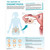 The Anatomy of Endometriosis Chart/Poster