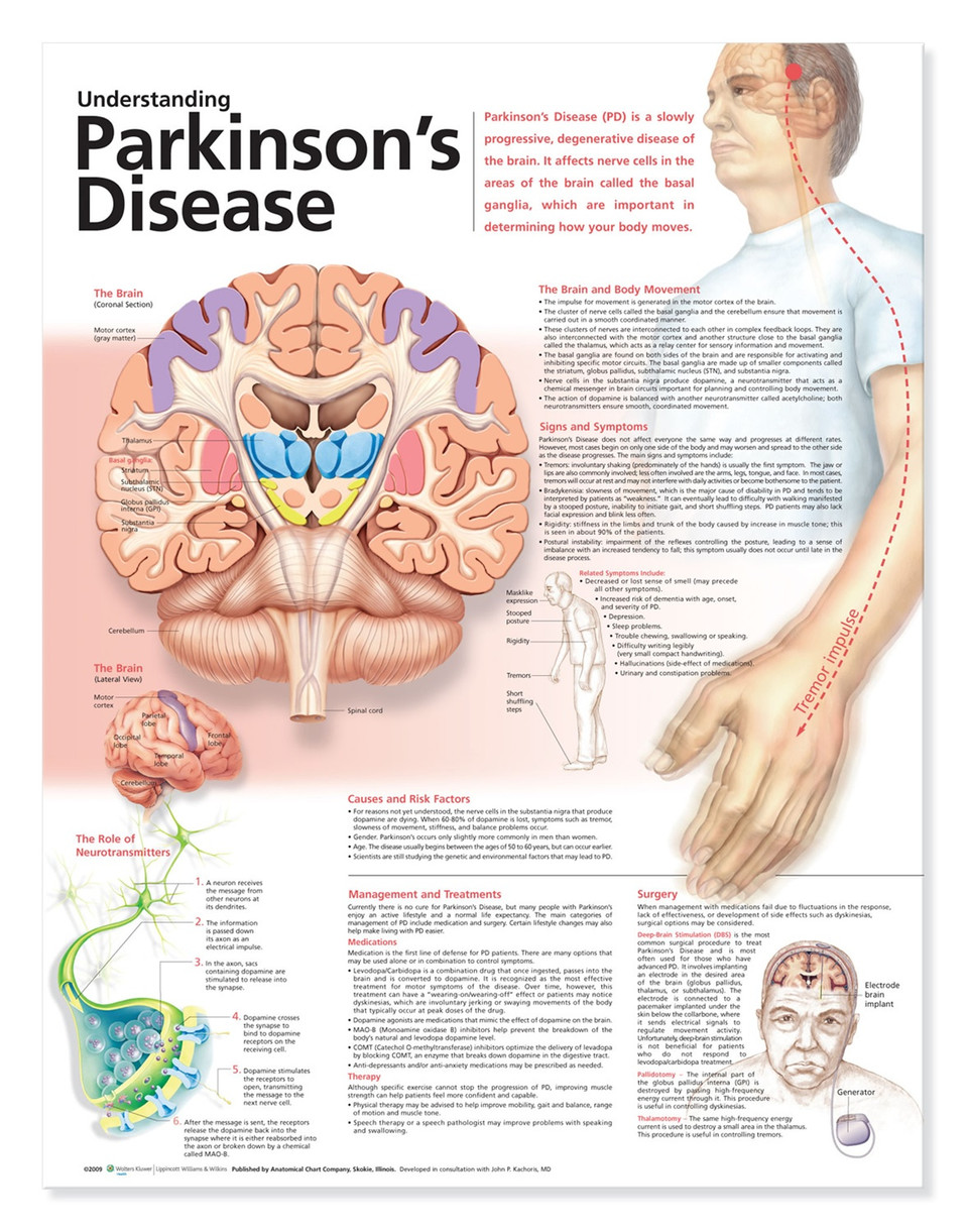 parkinson's disease research paper outline