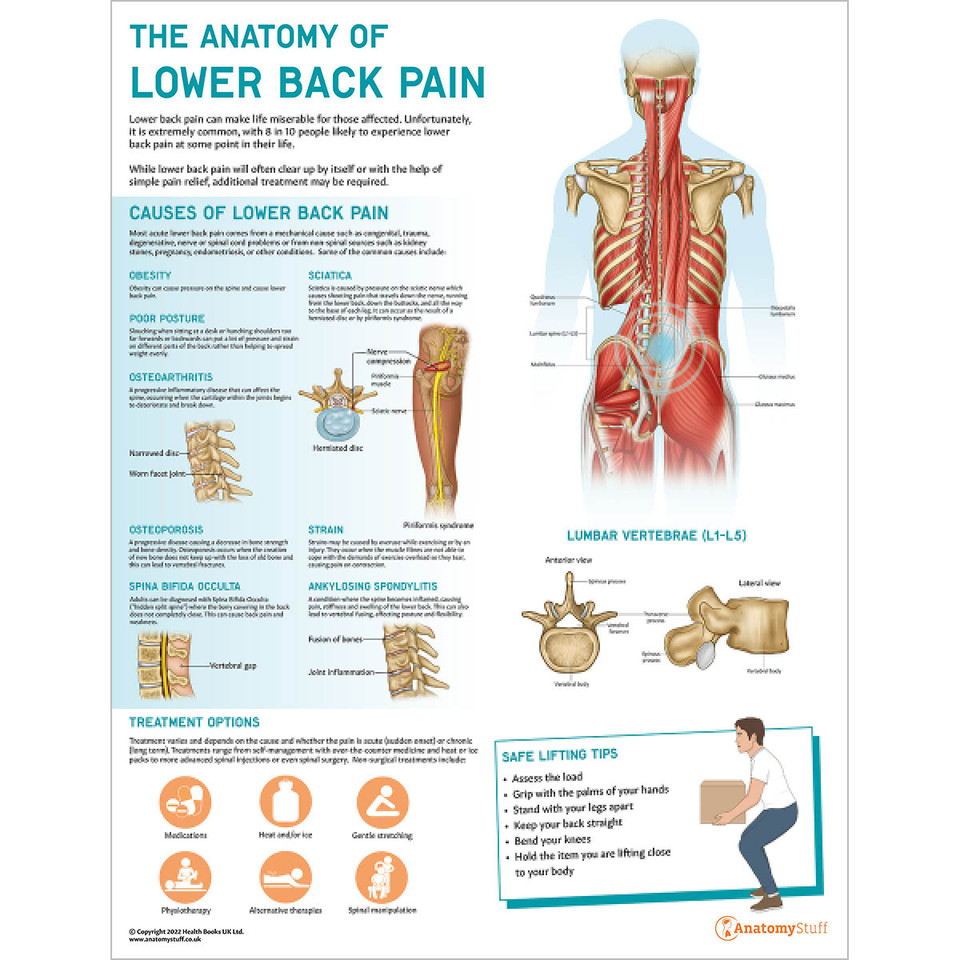 The Anatomy Of Lower Back Pain Low Back Pain AnatomyStuff   The Anatomy Of Lower Back Pain Poster Chart  14775.1671554711 