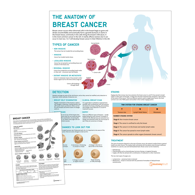 Breast Cancer Education | AnatomyStuff