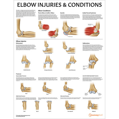 Elbow Injuries and Conditions Anatomy Chart / Poster - Laminated