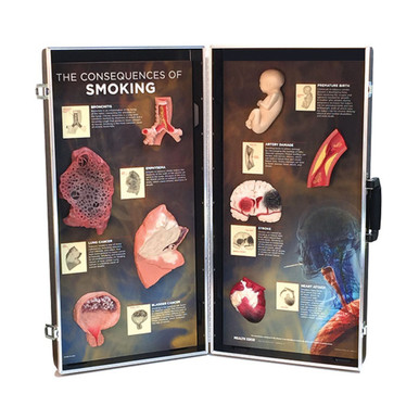 The Consequences of Smoking 3D Display