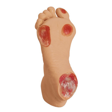 Elderly Pressure Ulcer Foot Model