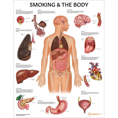 Smoking and The Body Chart / Poster - Laminated