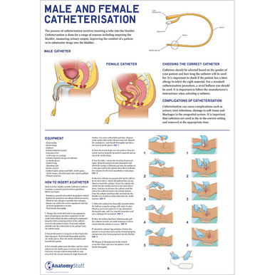 Male and Female Catheterisation Poster - Laminated