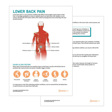 Lower back pain advice - Milton Keynes University Hospital