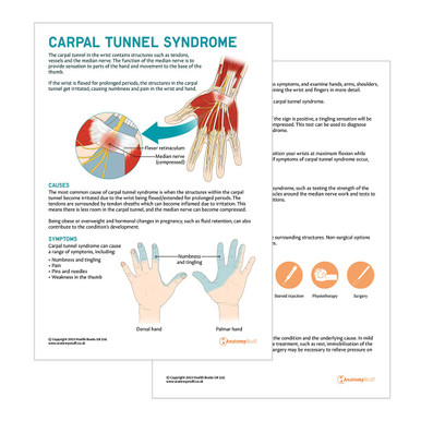 Carpal Tunnel Syndrome Patient Education Handout (Printable PDF)