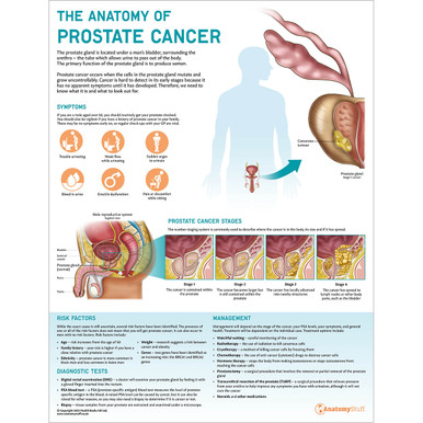 The Anatomy of Prostate Cancer Chart / Poster - Laminated