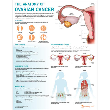 The Anatomy of Ovarian Cancer Chart / Poster - Laminated