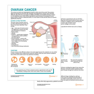 Ovarian Cancer Patient Education Handout (Printable PDF)