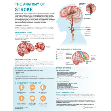 The Anatomy of Stroke Chart / Poster - Laminated