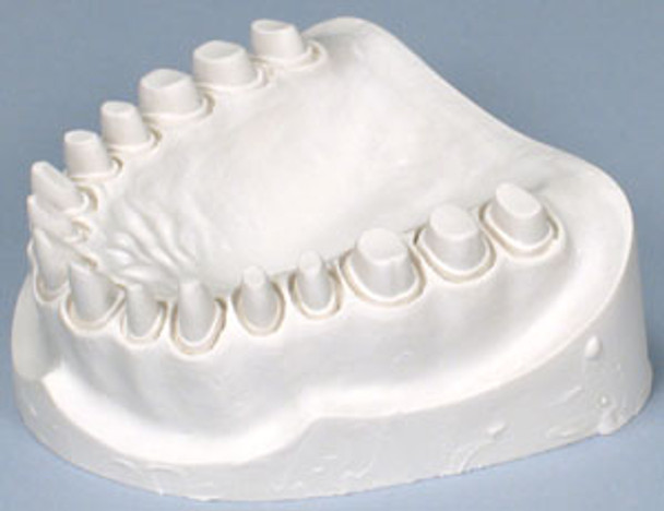 Gresco Dental Lab Stone - High Density - Natural White Faster Set - 20 Kg