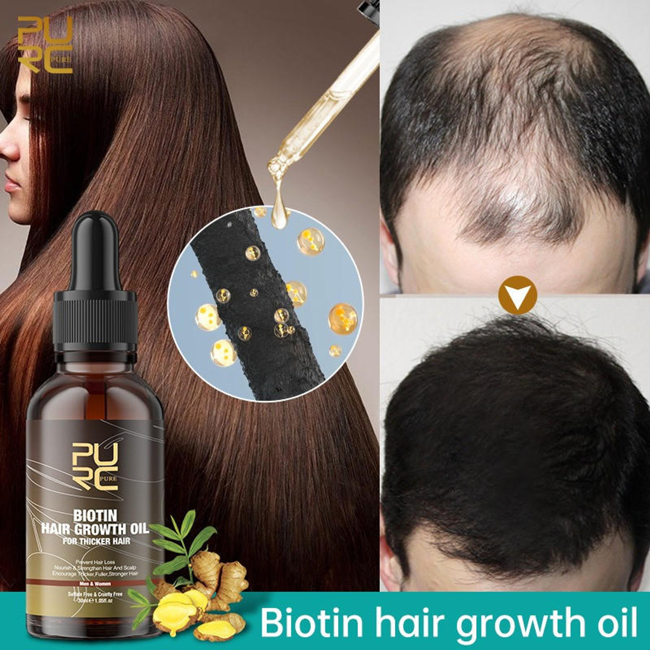 Aggregate more than 136 biotin for hair growth results latest - camera ...