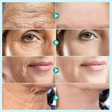 NECK & CHEST WRINKLE REMOVER: Say Goodbye to Wrinkles and Reveal Smooth, Youthful Skin
