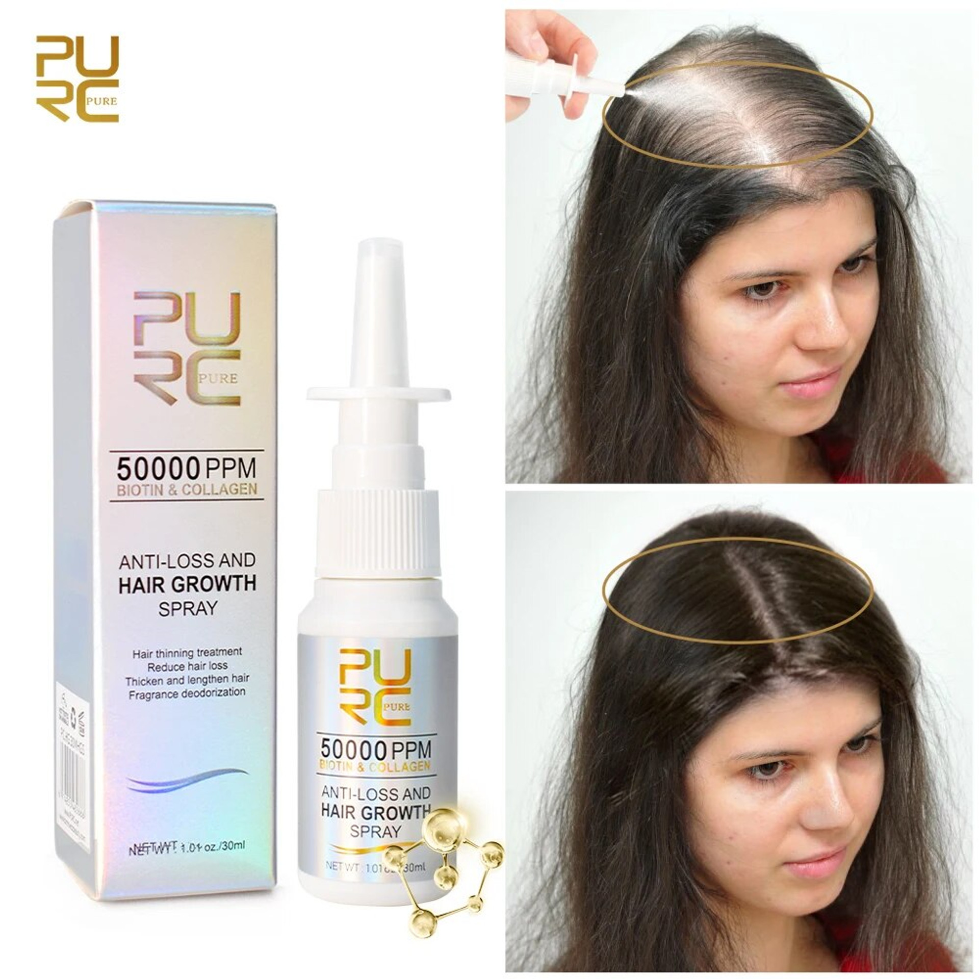 HAIR GROWTH SPRAY 【50% OFF】 PURC FAST HAIR GROWTH SPRAY BONDI & BEARD