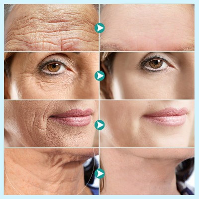 NECK & CHEST WRINKLE REMOVER: Say Goodbye to Wrinkles and Reveal Smooth, Youthful Skin