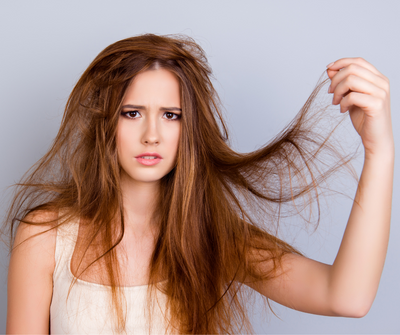 HOW TO GET RID OF DANDRUFF: What is Dandruff?