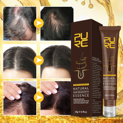 Hair growth spray is a topic of interest for many individuals who desire thicker, fuller, and healthier hair
