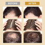 B5G5 Biotin Fast Hair Growth Products for Men & Women Anti Hair Loss Serum Spray Scalp Treatment Thicken Regrowth Oil Hair Care