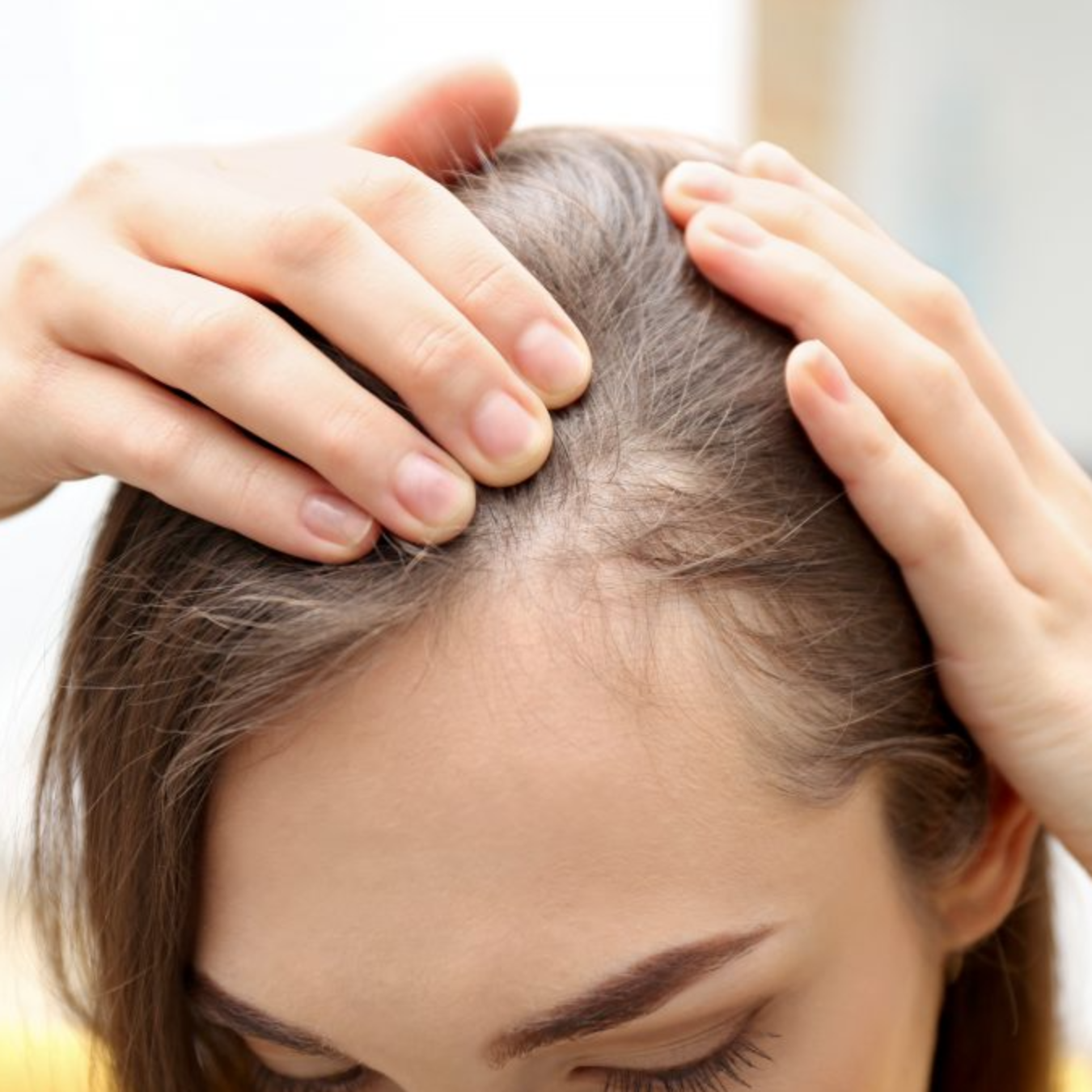 Hair Loss and Alopecia Treatments: Best Hair Growth Products for Thin Hair