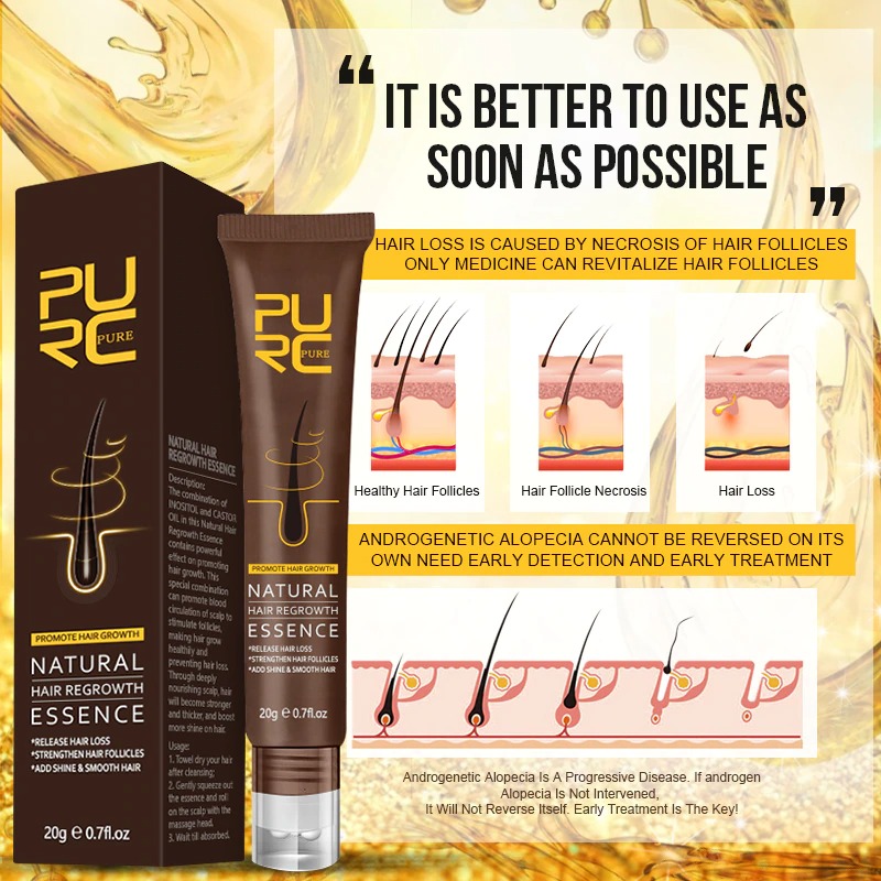 purc-fast-hair-growth-oil-prevent-hair-l-main-4.jpg