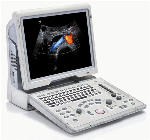 Mindray Z6 Digital Diagnostic Ultrasound