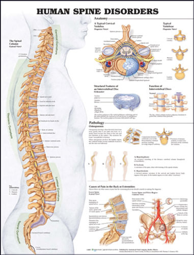 HUMAN SPINE DISORDERS POSTER 51X66CM