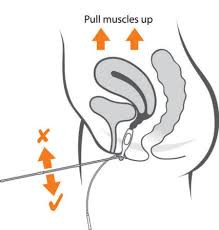 Periform Plus Intra Vaginal Probe is used to treat stress, mixed or urge incontinence.