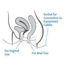 Anuform can be used for anal or vaginal treatment.