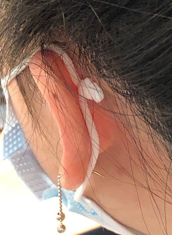 Knot rests comfortably and does not irritate ear 