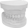 OrthoStone orthodontic stone OrthoStone orthodontic stone