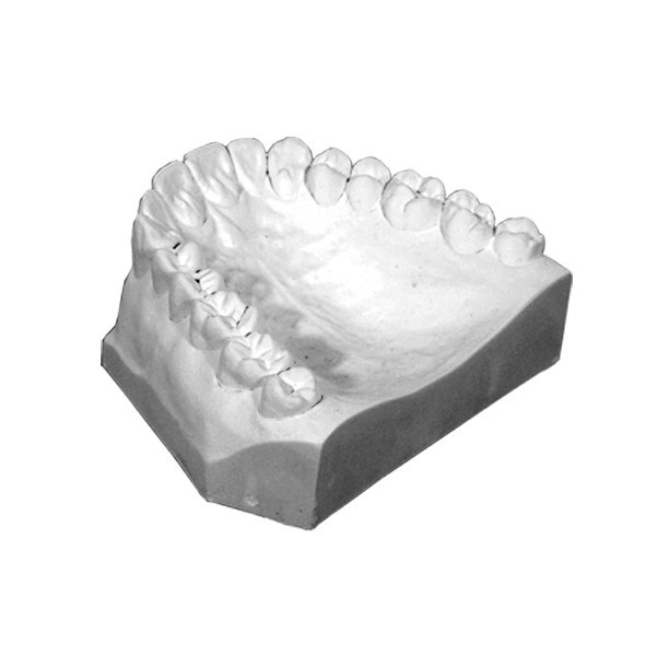 Implant Scanning Stone - 40 lbs