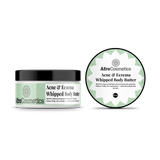 Whipped Body Butter – Acne & Eczema (8 oz)