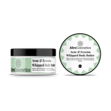 Acne & Eczema – Whipped Body Butter (8 oz)