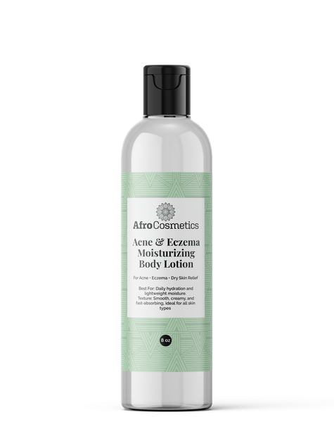 Acne & Eczema – Moisturizing Body Lotion (8 oz)