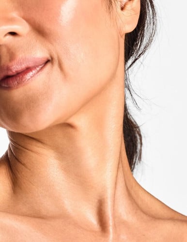 Laser Skin Tightening - Neck | Laser Clinics Canada