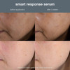 Smart Response Serum Jumbo
