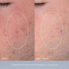 Daily Microfoliant Full + Travel