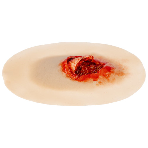 TraumaSim Self-Adhesive Open Fracture